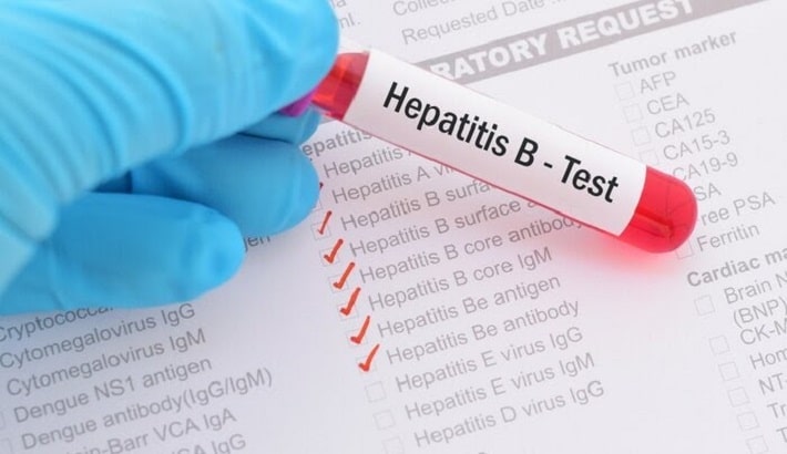 (Hepatitis B surface antigen)HBsAg